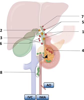 Progress in gallbladder cancer with lymph node metastasis